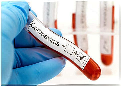 A Covid-19 screening test