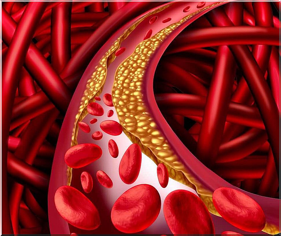 vitamin E against cholesterol