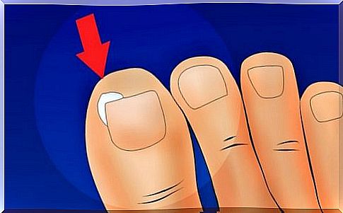 Causes of ingrown toenails 