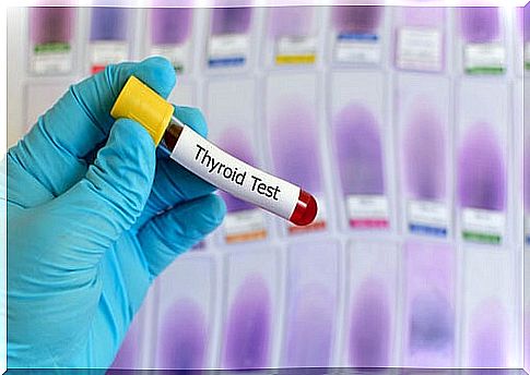 tube of a blood test to diagnose hypothyroidism