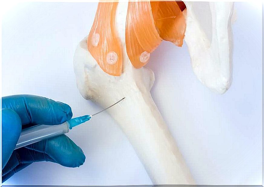 Liquid biopsy and bone marrow sampling